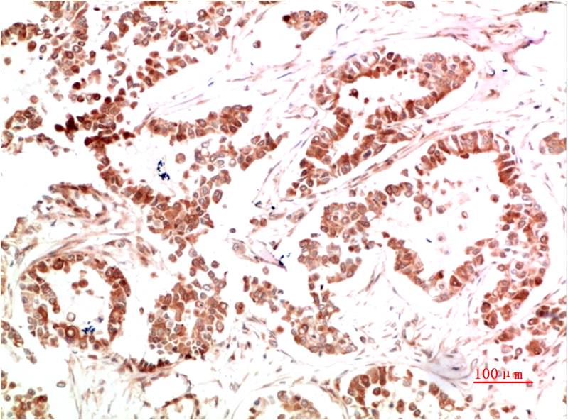 Met Polyclonal Antibody (c-met)