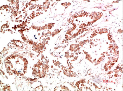 Met Polyclonal Antibody (c-met)
