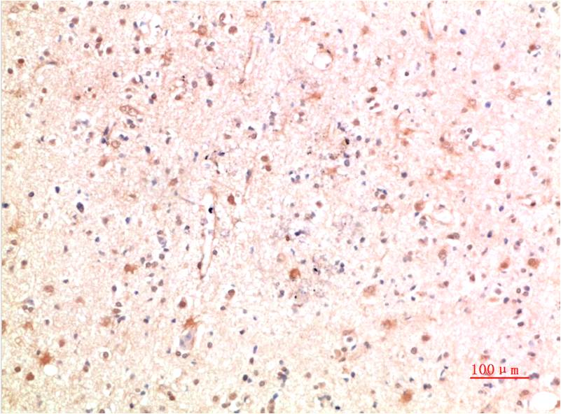 PI3 Kinase P85 Polyclonal Antibody (PI3K p85)