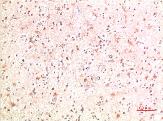 PI3 Kinase P85 Polyclonal Antibody (PI3K p85)