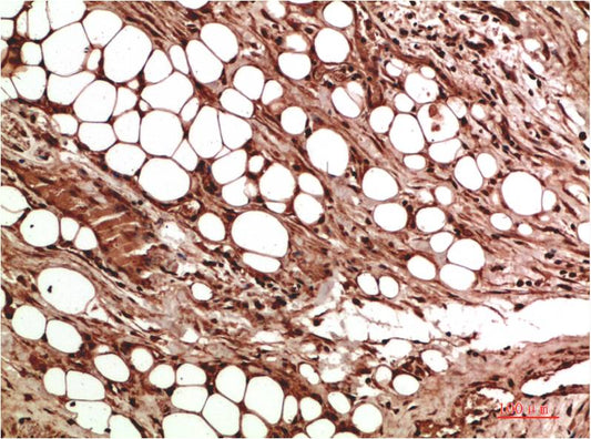VEGF Polyclonal Antibody (VEGF)