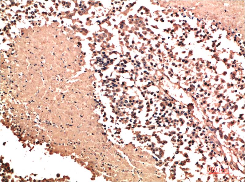 NM23A Polyclonal Antibody (NM23)