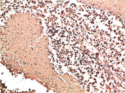 NM23A Polyclonal Antibody (NM23)