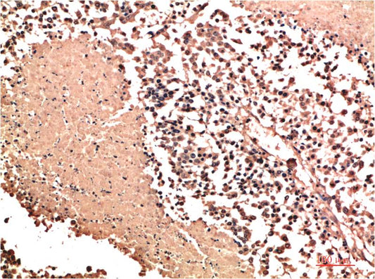 NM23A Polyclonal Antibody (NM23)