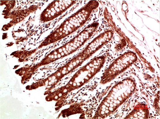 ATM Polyclonal Antibody (ATM-1)
