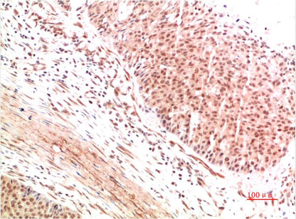 ATM Polyclonal Antibody (ATM-2)