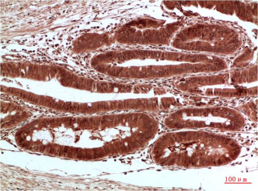 Acetyl-CoA Carboxylase Polyclonal Antibody (F104)