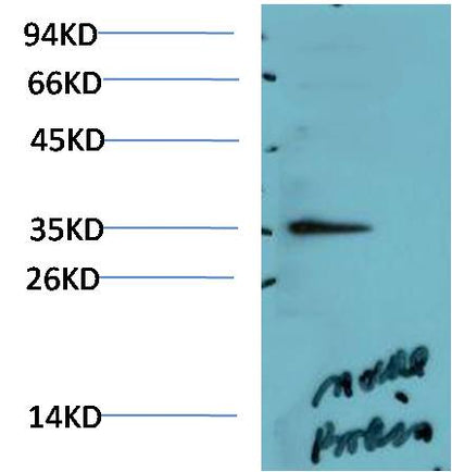 AMPK Gamma1 Polyclonal Antibody (F114)