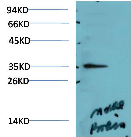 AMPK Gamma1 Polyclonal Antibody (F114)