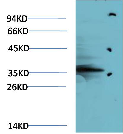AMPK Gamma1 Polyclonal Antibody (F115)