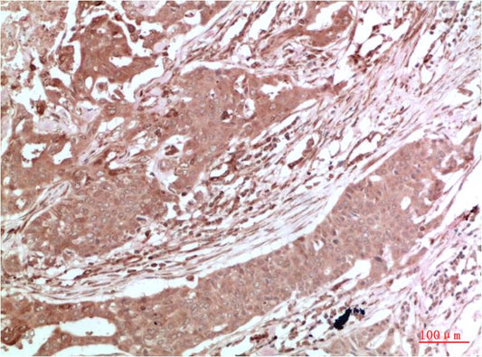 AMPK Alpha2 Polyclonal Antibody (F117)