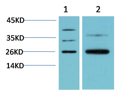 HP-1 Beta Polyclonal Antibody (HP-1 b）
