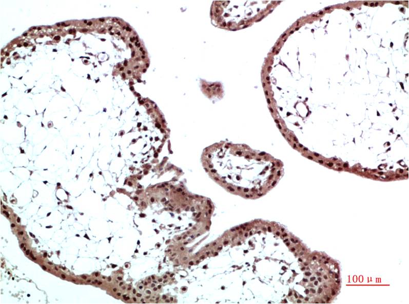 HP-1 Beta Polyclonal Antibody (HP-1 b）