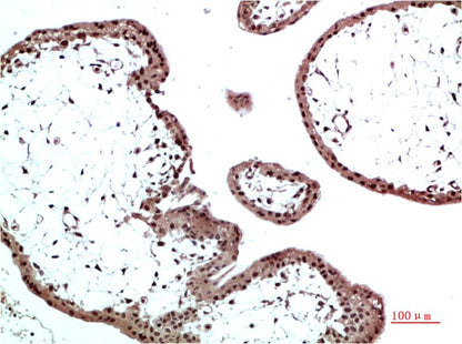 HP-1 Beta Polyclonal Antibody (HP-1 b）