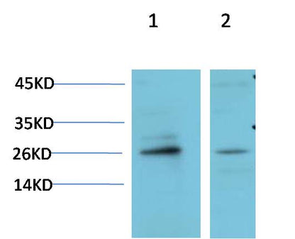 HP-1 Gamma Polyclonal Antibody (HP-1 g）