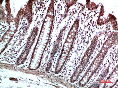 HP-1 Gamma Polyclonal Antibody (HP-1 g）