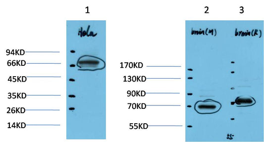 HSC70 Polyclonal Antibody (F155)