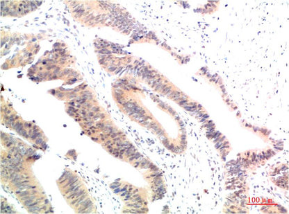 HSP90 Alpha Polyclonal Antibody (F165)