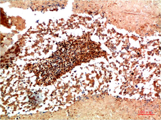 JAK1 Polyclonal Antibody (F172)