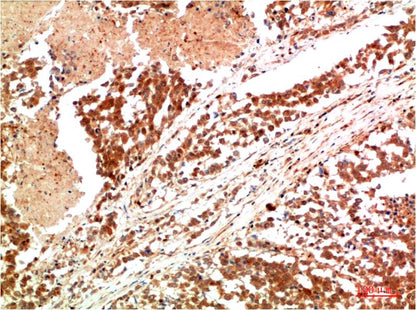 JAK1 Polyclonal Antibody (F172)