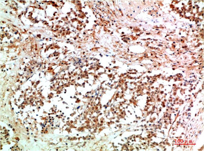 JAK2 Polyclonal Antibody (F175)