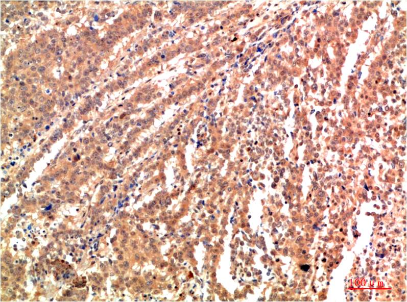 JNK2 Polyclonal Antibody (F182)