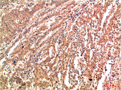 JNK2 Polyclonal Antibody (F182)