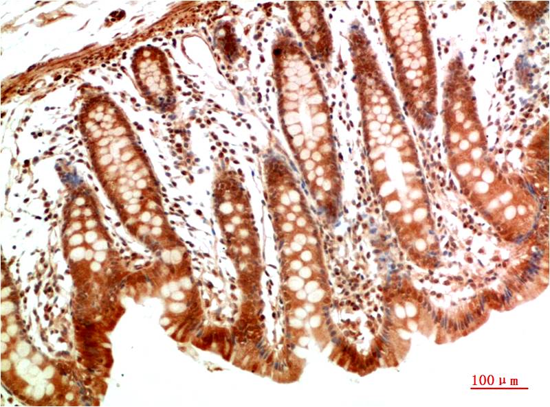 MEK2 Polyclonal Antibody (F190)
