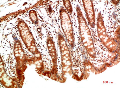 MEK2 Polyclonal Antibody (F190)