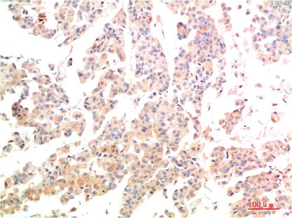 MEK3 Polyclonal Antibody (F192)