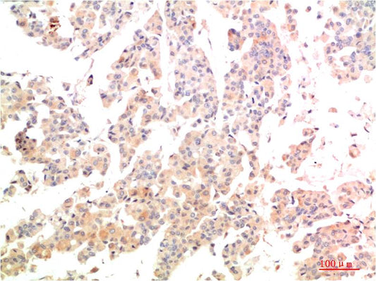 MEK3 Polyclonal Antibody (F192)