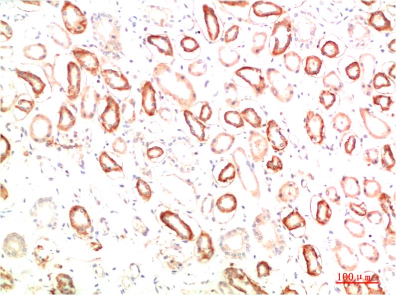 MEK3 Polyclonal Antibody (F192)