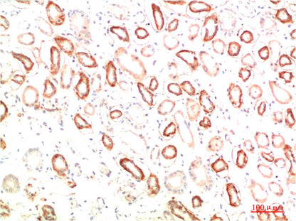 MEK3 Polyclonal Antibody (F192)