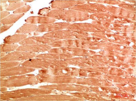 ATG4b Polyclonal Antibody (F304）