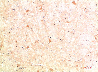 ATG4b Polyclonal Antibody (F304）