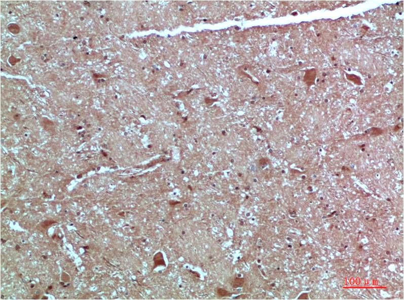 ATG4c Polyclonal Antibody (F306）