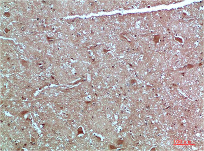ATG4c Polyclonal Antibody (F306）