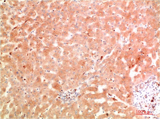 ATG5 Polyclonal Antibody (F307）