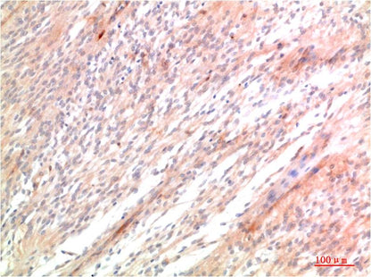 ATG5 Polyclonal Antibody (F307）