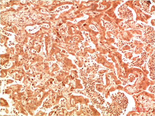 ATG7 Polyclonal Antibody (F309）
