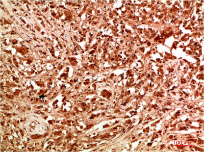ATG7 Polyclonal Antibody (F309）