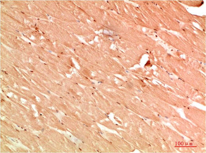 ATG13 Polyclonal Antibody (F310）