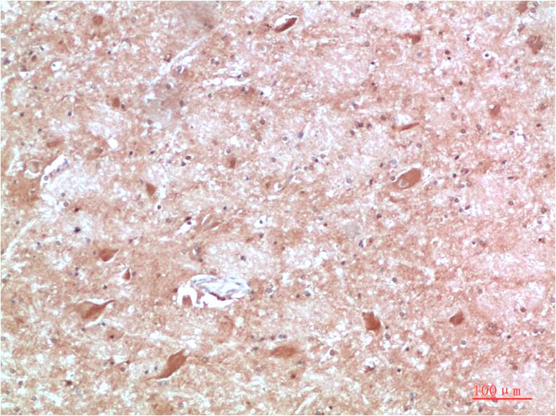 ATG13 Polyclonal Antibody (F311）