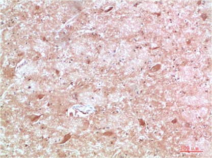 ATG13 Polyclonal Antibody (F311）