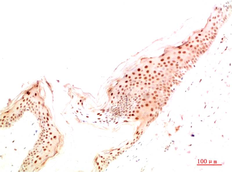 ATG14L Polyclonal Antibody (F313）