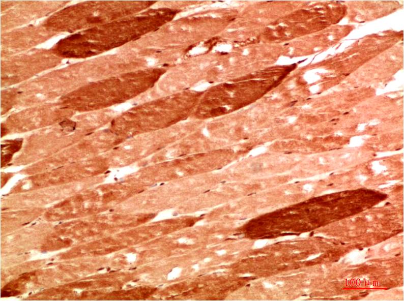 NBR1 Polyclonal Antibody (F317）