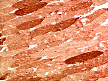 NBR1 Polyclonal Antibody (F317）
