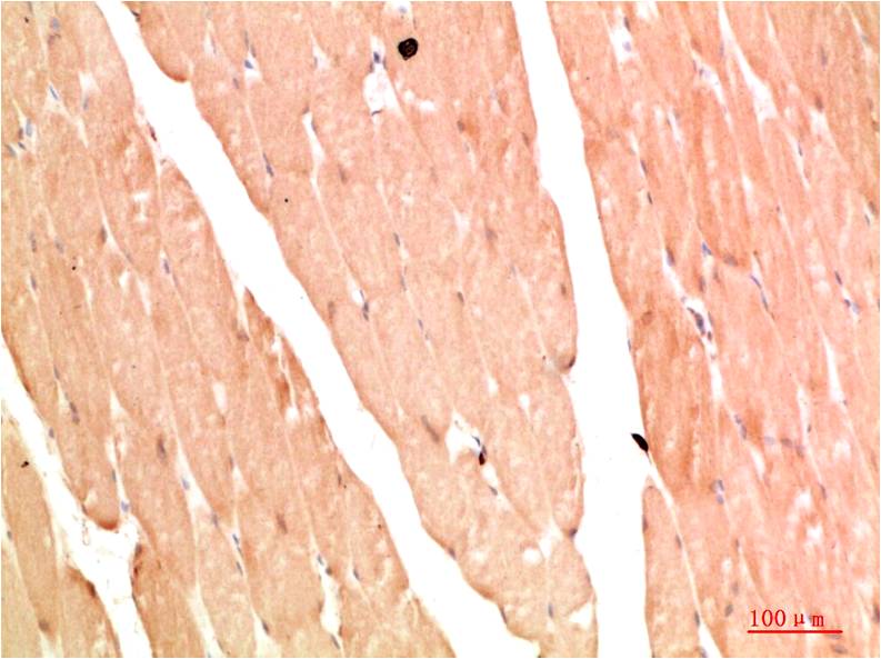 NBR1 Polyclonal Antibody (F318）