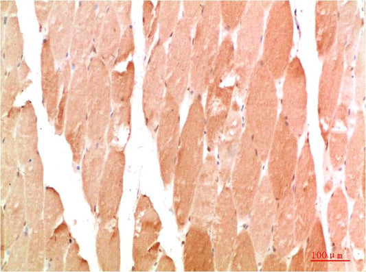WIPI2 Polyclonal Antibody (F327）