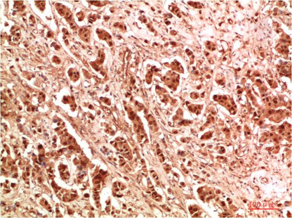 WIPI2 Polyclonal Antibody (F327）